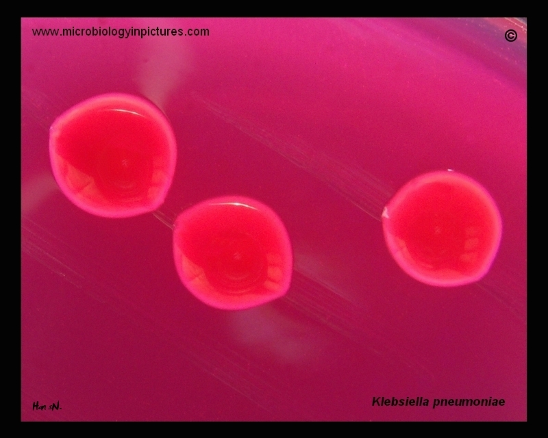 Klebsiella pneumoniae on Endo